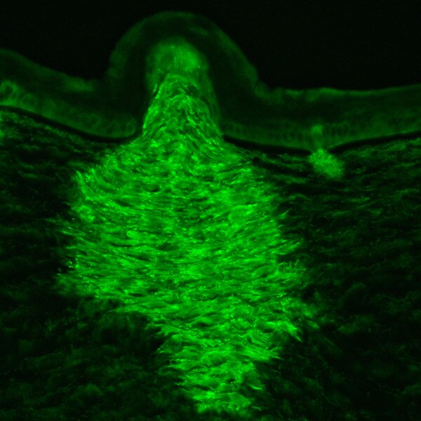 Immunofluorescent image of a transverse chicken cornea section 4 days post corneal injury labeled with DSHB antibody VN 3-24 against vinculin. Image Credit: Andy J. Fischer, PMID 21976955, Fig. 2H.